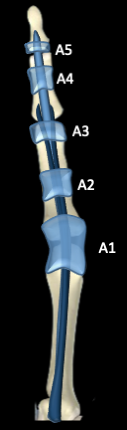 

Flexor pulley system

